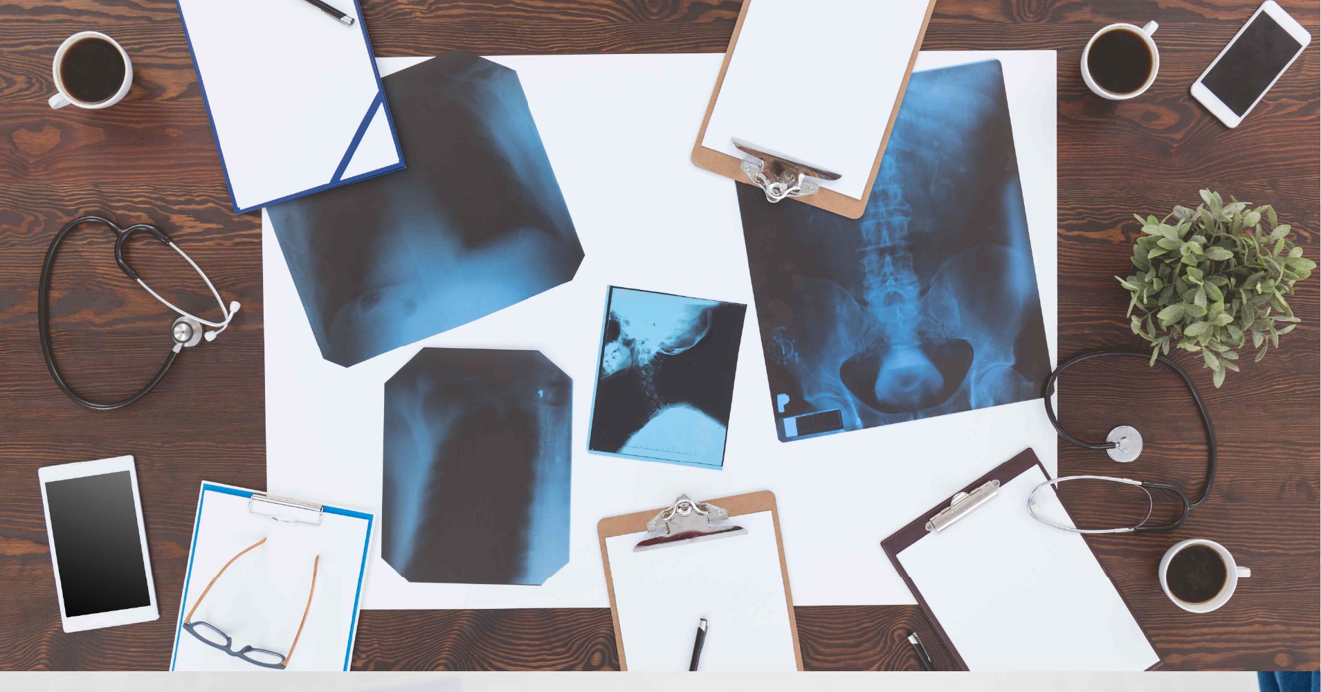 AI in Radiology: Transforming Diagnostic Imaging for Greater Accuracy 25